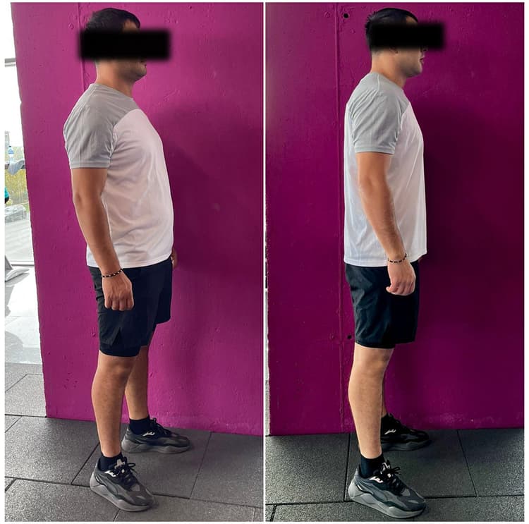 Before and after 13
