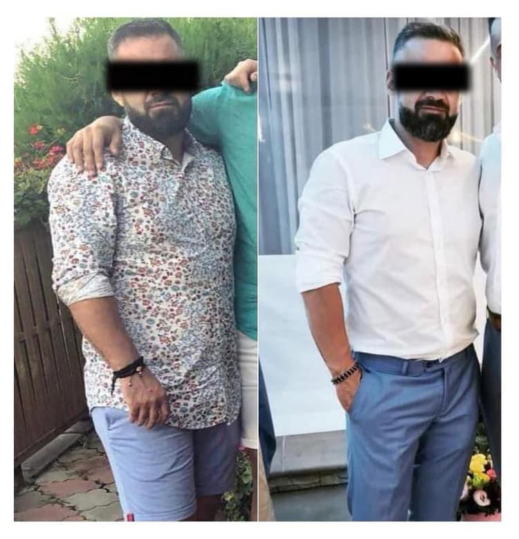 Before and after 5