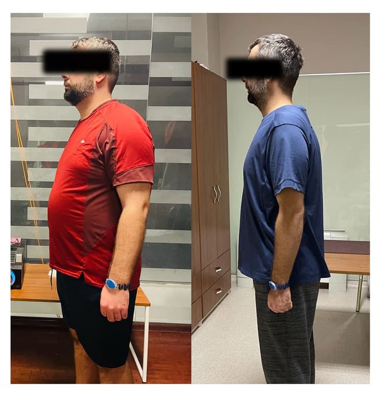 Before and after 6